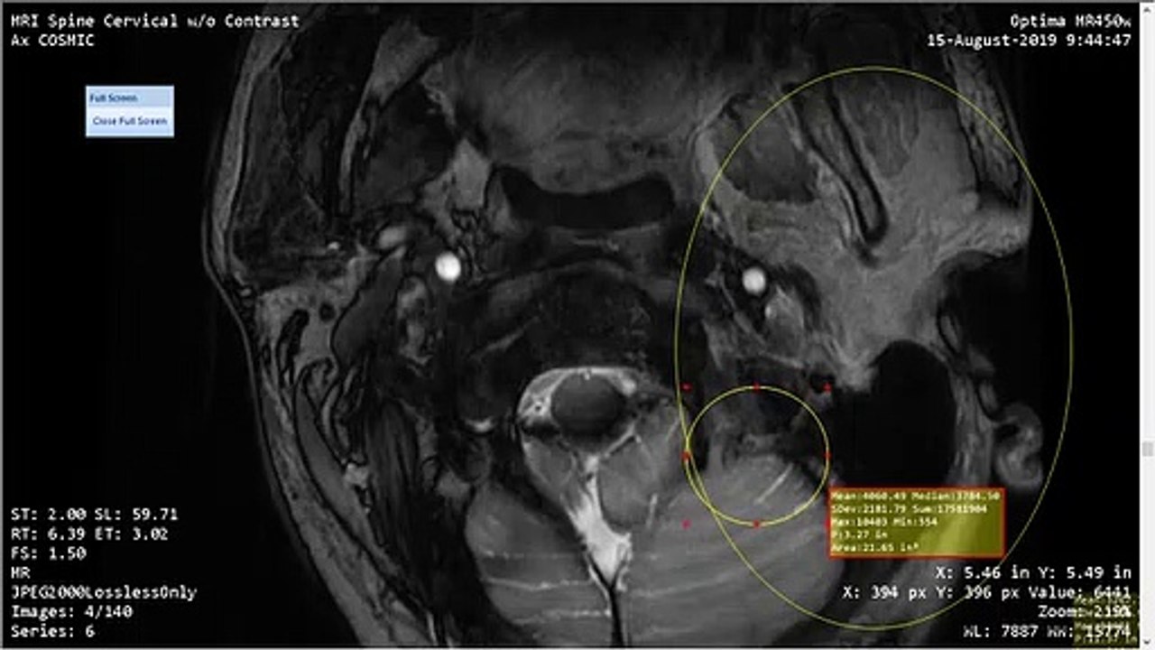 My Plight Pursuing MRI - Birmingham Alabama Needs Charity MRI Service For People With No Money