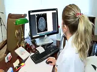 'Koronavirüsü belirtisiz geçirenlerde inme riski daha yüksek'