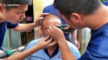 Chinese man lucky to avoid serious injury after fishing hook pierces his forehead