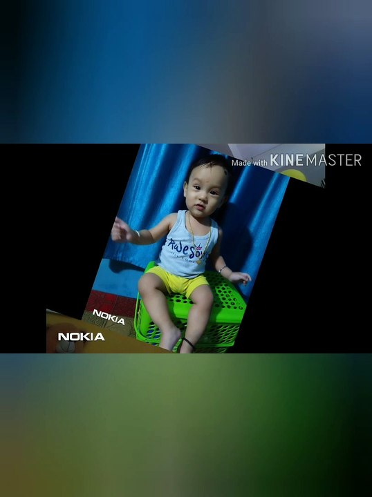 JOJO Sai Rana. NICU survivor because he is preterm birth.