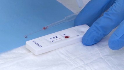 La 'cartilla Covid-19' de Ayuso continúa en el centro de la polémica