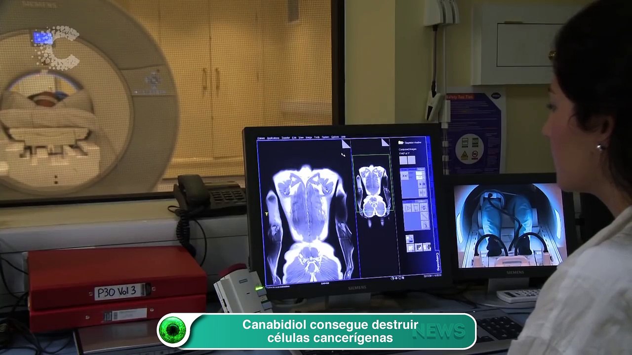 Canabidiol consegue destruir células cancerígenas