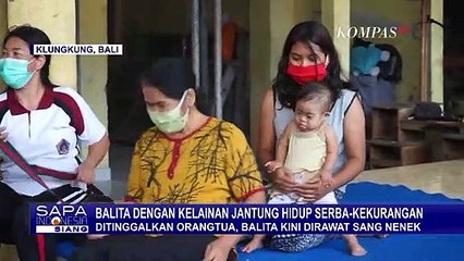 Download Video: Miris! Ditinggalkan Orangtua, Balita Kelainan Jantung Kini Dirawat Sang Nenek