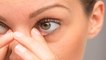 Eye Itching Home Remedy: आंखों में खुजली हो तो क्या करें | आंखों में खुजली के उपाय | Boldsky