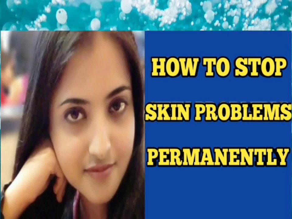 HOW TO GET CLEAR SKIN NATURALLY | ULTIMATE SKINCARE ROUTINE TO STOP SKIN PROBLEMS | FAST & COMPLETE