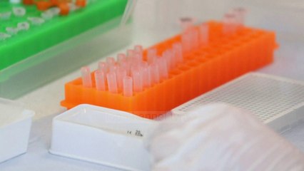 Top News - Imuniteti sëmundjes/ Ekspertët: Ikën për disa muaj