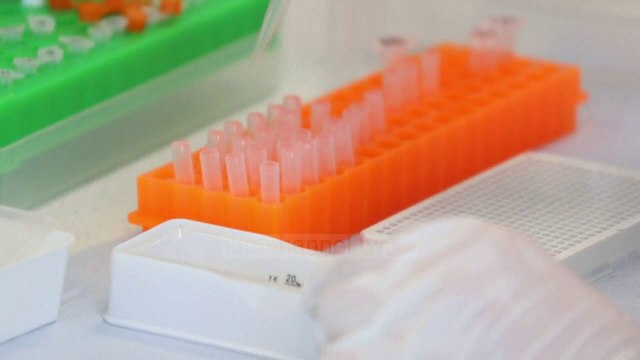 Top News - Imuniteti sëmundjes/ Ekspertët: Ikën për disa muaj