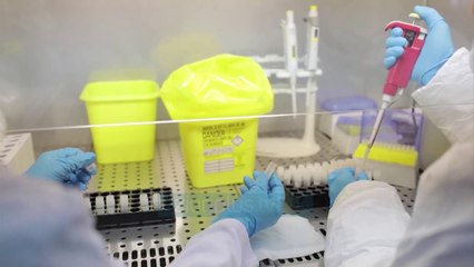 Sulçebe: Analizat serologjike nuk tregojne nese je prekur nga Covid - Vizion Plus