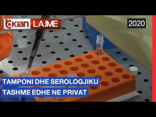 Tamponi dhe serologjiku tashme edhe ne privat | Lajme-News