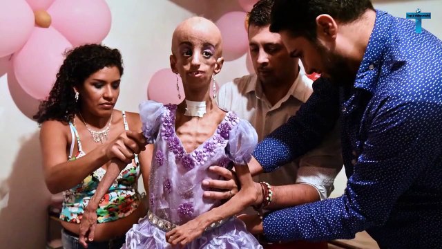 Top 10 Truly Unusual Teens You Won't Believe Actually Exist