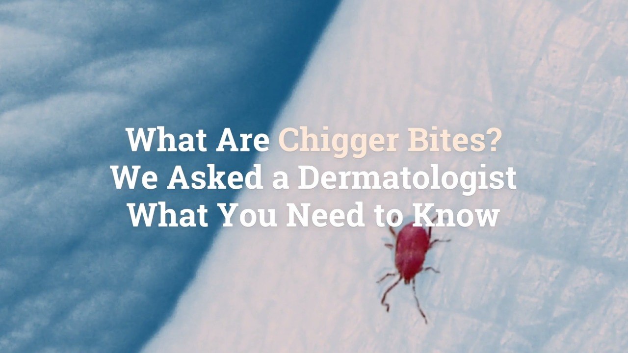 What Are Chigger Bites? We Asked a Dermatologist What You Need to Know