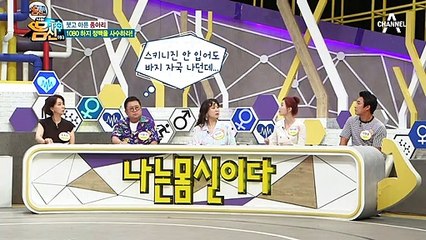 하지 정맥류가 심해지면 다리를 절단해야 할 수도 있다고?!