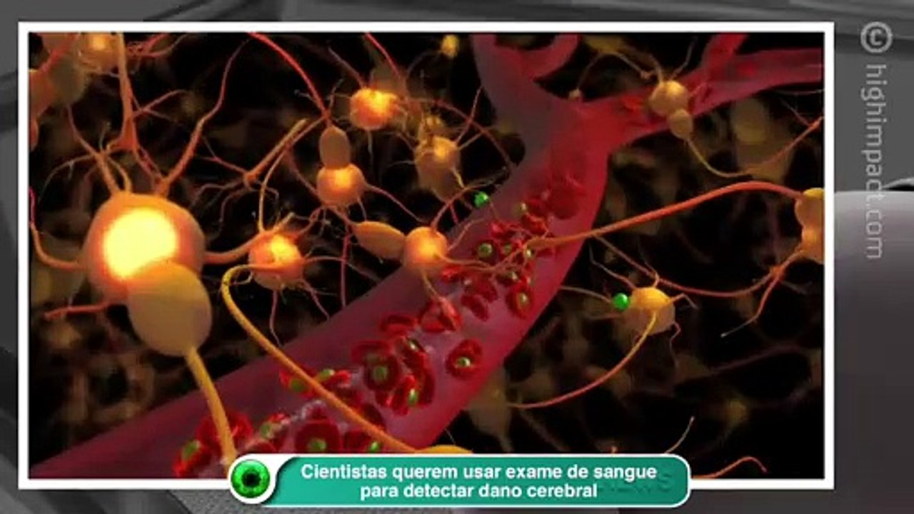 Cientistas querem usar exame de sangue para detectar dano cerebral