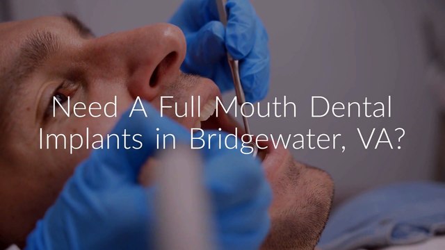 Full Mouth Dental Implants : Smiles for Life Dental Care