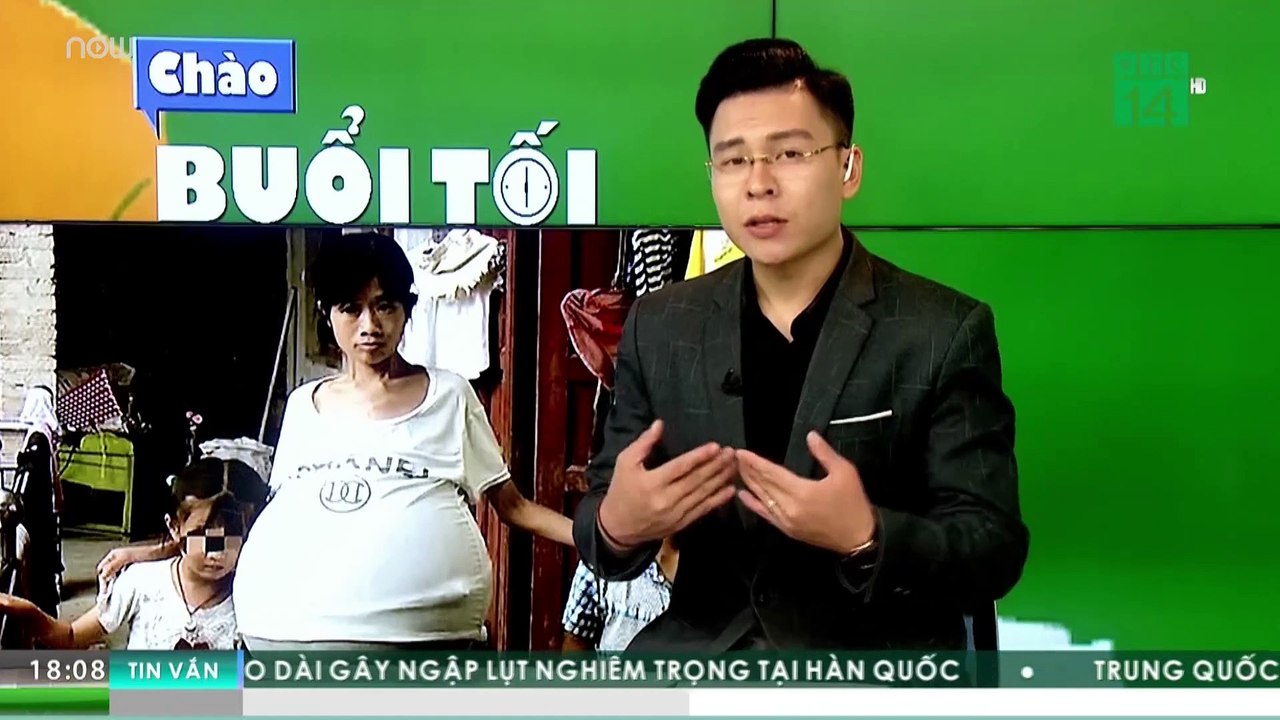 Chuyện lạ: Không mang thai dù bụng "phình" to | VTC