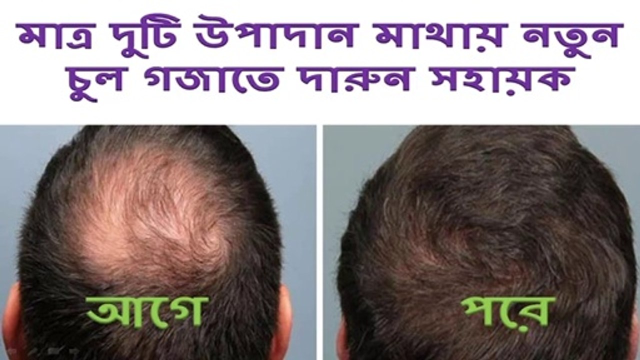 Grow New Hair naturally with two elements ।। New hair growth ।। beauty tips