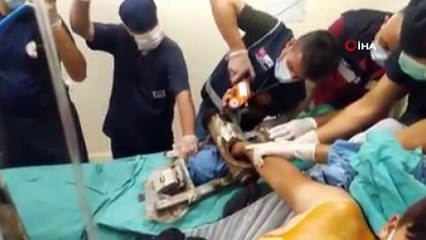 Eli salça makinasına sıkışan genç için doktorlar ve itfaiye seferber oldu