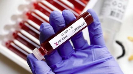 India's Covid-19 cases stand at 21.53 lakh with over 43,000 deaths