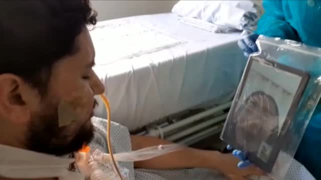 Los jóvenes no son inmunes: algunos sufren los efectos más graves del virus