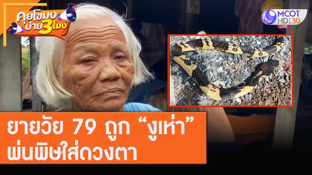 ยายวัย 79 ถูก “งูเห่า” พ่นพิษใส่ดวงตา [10 ส.ค. 63] คุยโขมงบ่าย 3 โมง | 9 MCOT HD