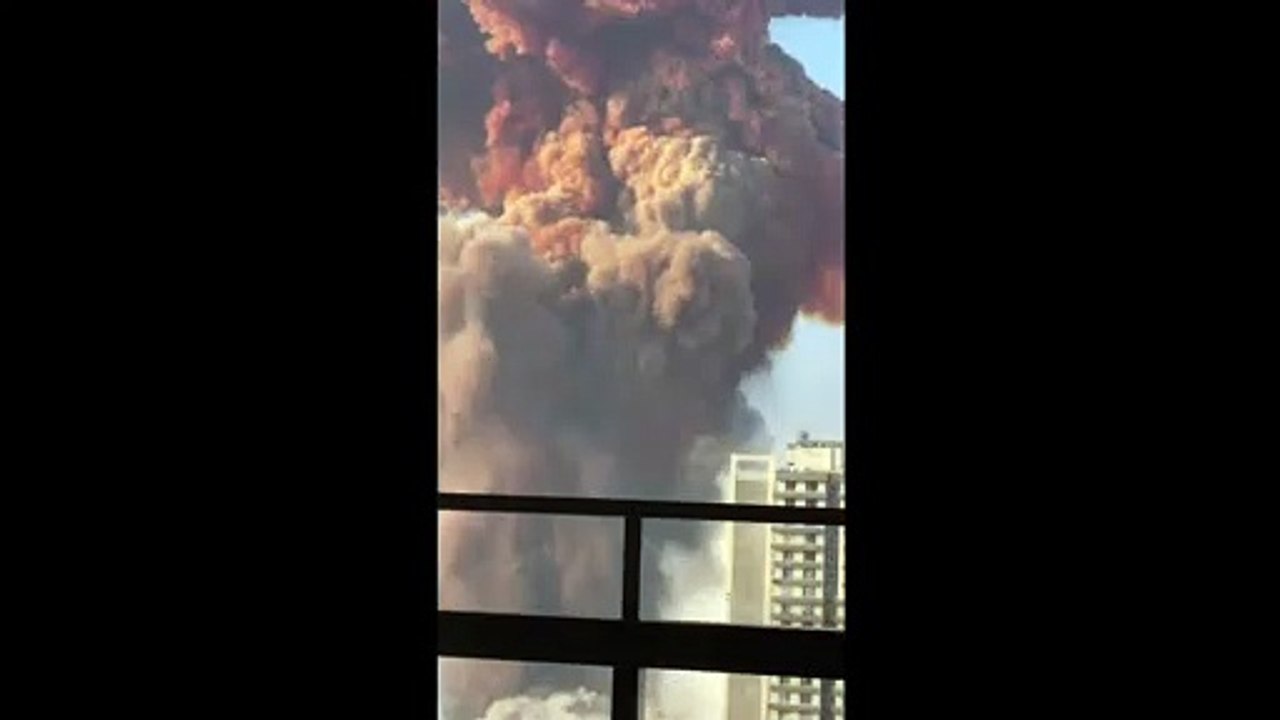 Massive Explosion in Lebanon,Here are some victim footages. May Almighty Help them.Ameen