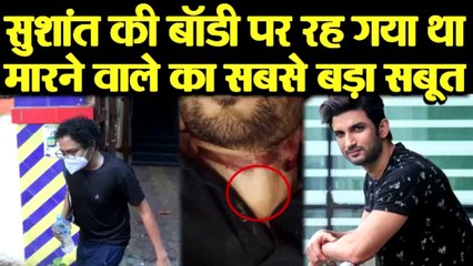 SUSHANT SINGH की BODY पर हत्यारे का सबसे बड़ा सबूत था लेकिन MUMBAI POLICE ने उस पर ध्यान नही दिया .