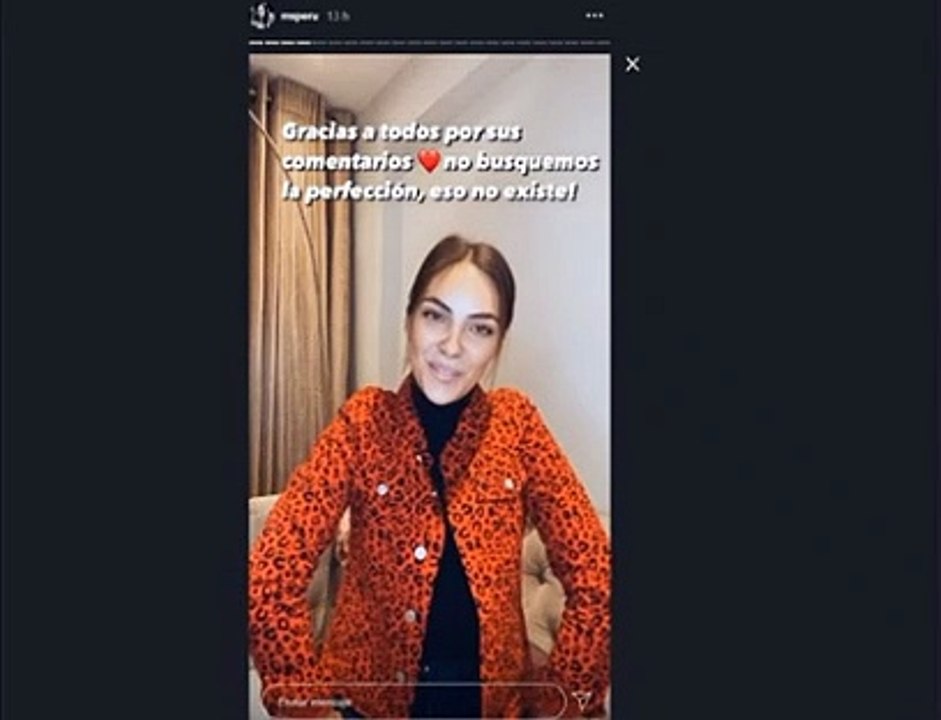 Natalie Vértiz muestra por primera vez su rostro con acné