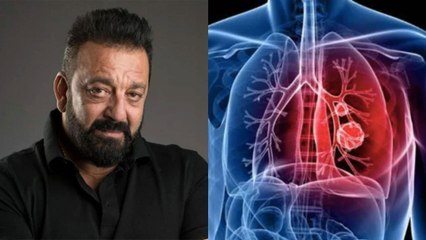 Know what is stage 3 lung cancer?