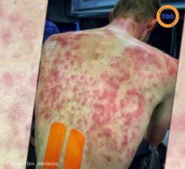Dauphiné : Violent orage lors de la 2e étape, les coureurs sont marqués