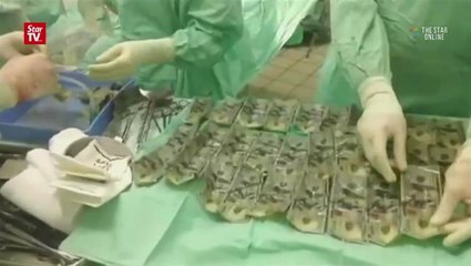 Colombian woman swallows US$7,000 in dispute with husband