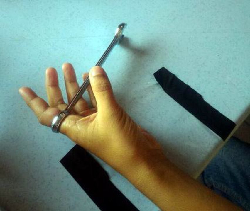 Boy's finger stuck in spanner for 4 hours
