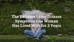 The Extreme Lyme Disease Symptoms One Woman Has Lived With for 3 Years