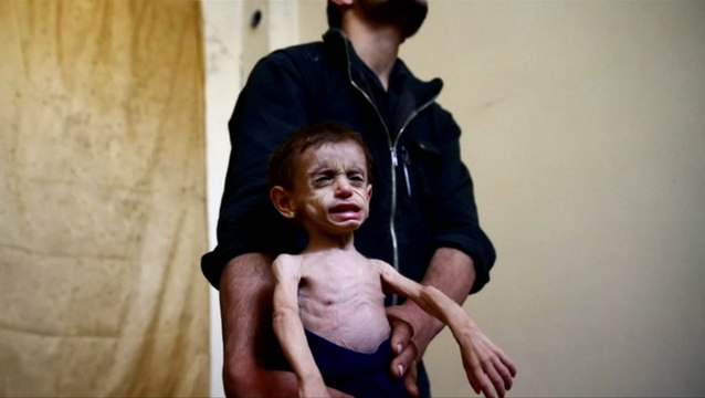 Critical patients evacuated from Syria's Ghouta