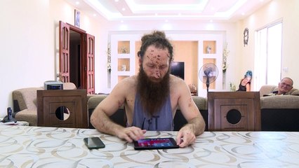 ناجٍ من انفجار بيروت يتحدث عن الفاجعة وندوبها العميقة