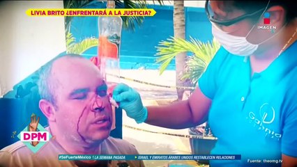 ¡Político aclara si Livia Brito lo buscó para ocultar agresión a fotógrafo!