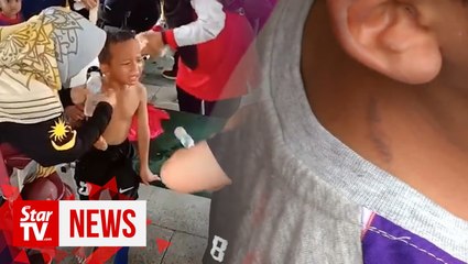 Balloon explosion at fitness event injures16