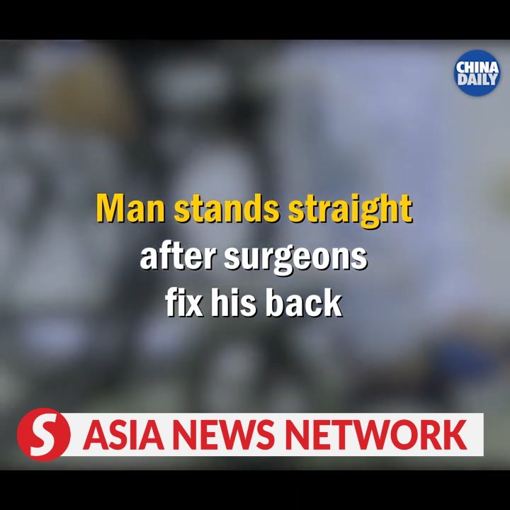 China Daily | Man stands straight after surgeons fix his back