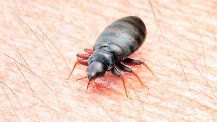 Can Bed Bugs Live In Your Hair?