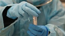 Thụy Sĩ phát hiện virus SARS-CoV-2 trong da người | VTC
