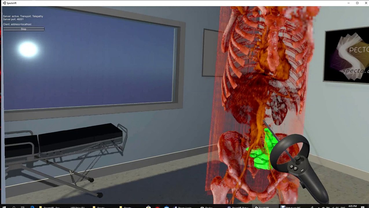 Virtuelle Realität im OP: Beispielvideo