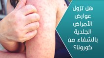 هل تزول عوارض الأمراض الجلدية بالشفاء من كورونا؟ - العيادة