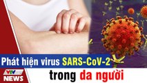 Phát hiện virus SARS-CoV-2 trong da người