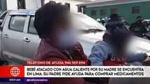 Bebé fue atacado con agua caliente por su madre y podría perder la vista, denuncia su expareja