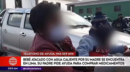 Bebé fue atacado con agua caliente por su madre y podría perder la vista, denuncia su expareja