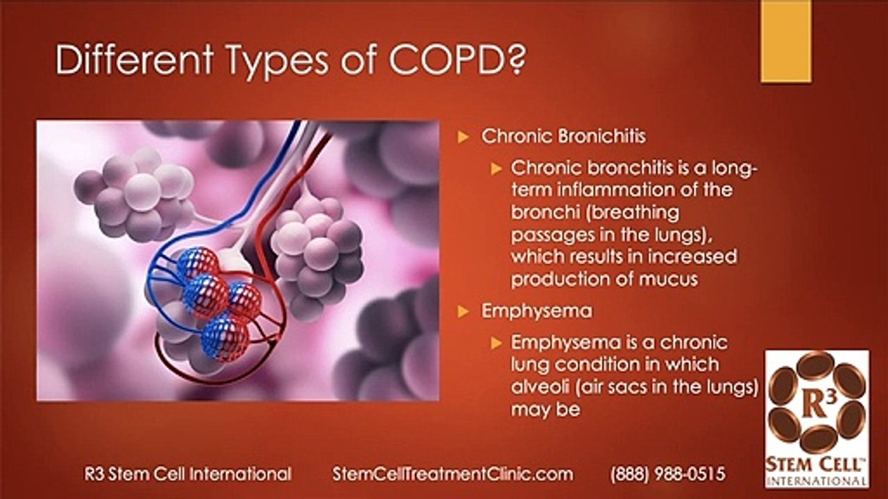 R3 International Stem Cell Treatment for COPD - Dr. David Greene Arizona
