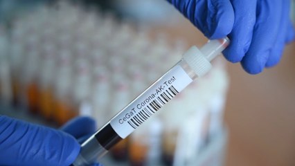 La Covid-19 deja más de 22,1 millones de casos y 781.000 muertos