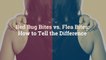 Bed Bug Bites vs. Flea Bites: How to Tell the Difference