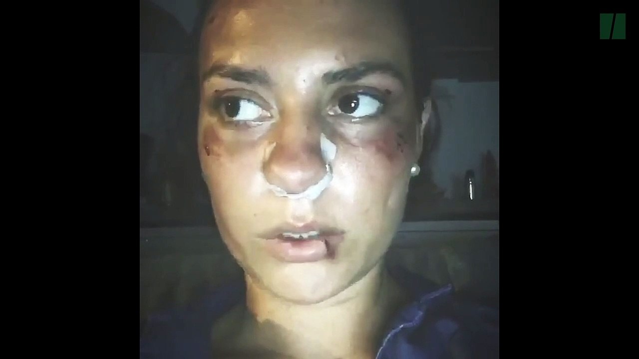 Nîmes: agressée en plein centre-ville, elle ne veut plus "avoir honte"