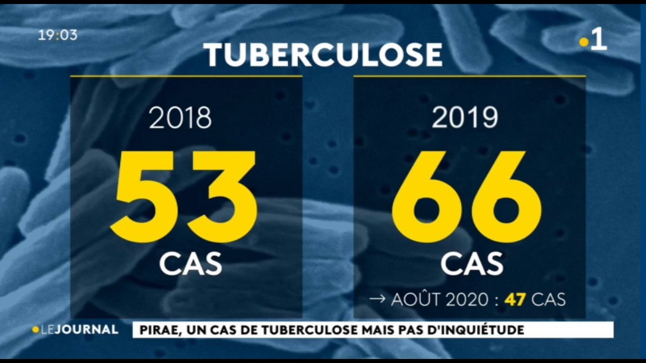 un cas suspect de tuberculose dans un lycée