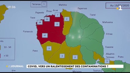 Covid 19 170 cas confirmés à ce jour